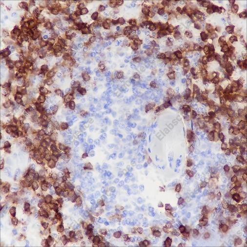 Recombinant CD79a Monoclonal Antibody - 2
