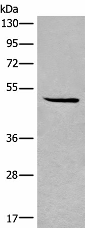 Western blot analysis of HL-60 cell lysate  using SPOCK3 Polyclonal Antibody at dilution of 1:400