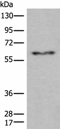 Western blot analysis of Human fetal liver tissue lysate  using CES2 Polyclonal Antibody at dilution of 1:600