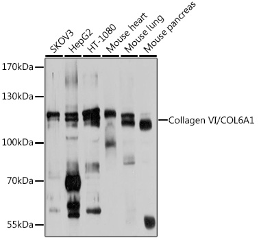 Western blot analysis of extracts of various cell lines using Collagen VI/Collagen VI/COL6A1 Polyclonal Antibody at 1:1000 dilution.