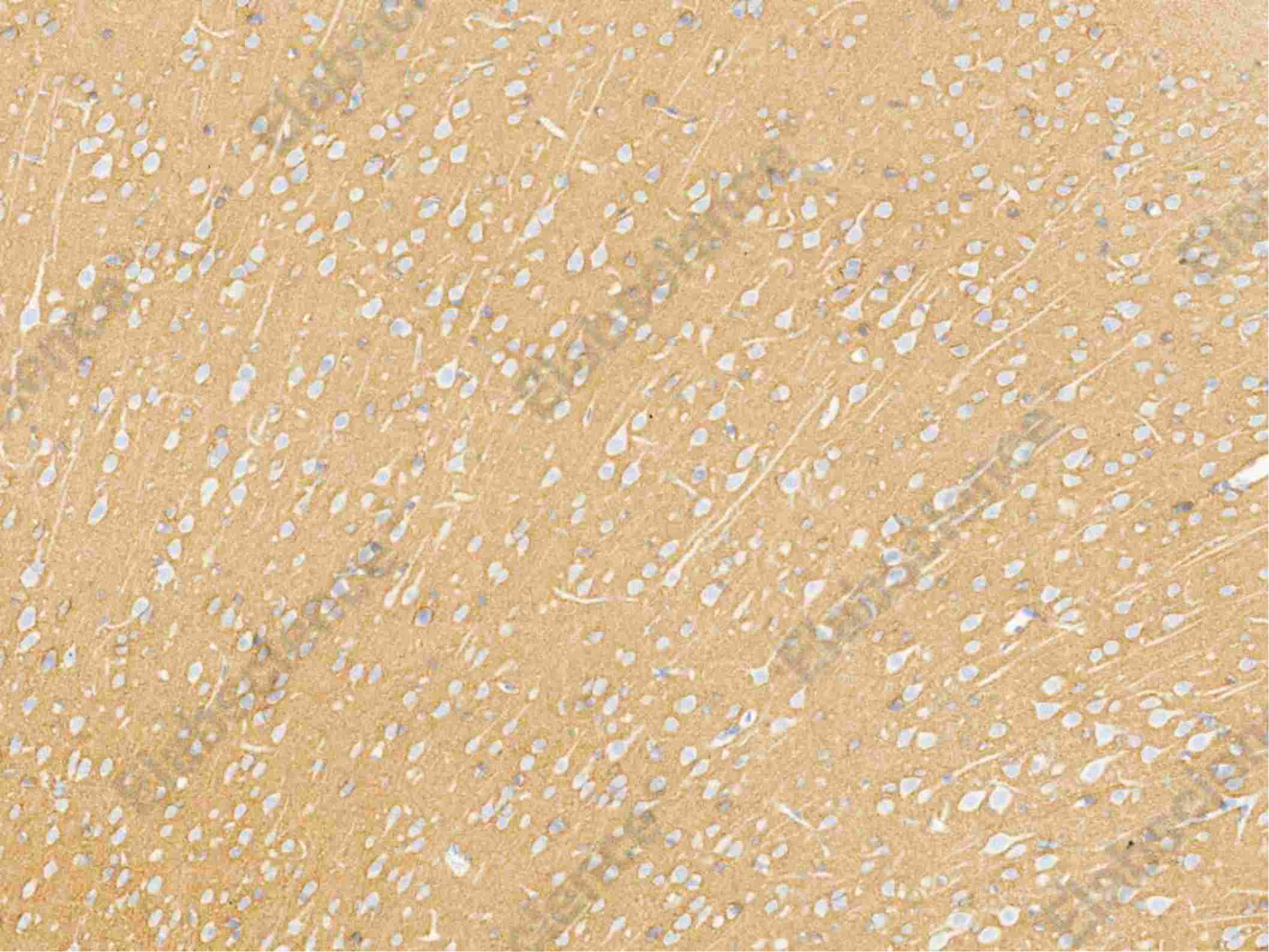 Recombinant NCAM Monoclonal Antibody - 2