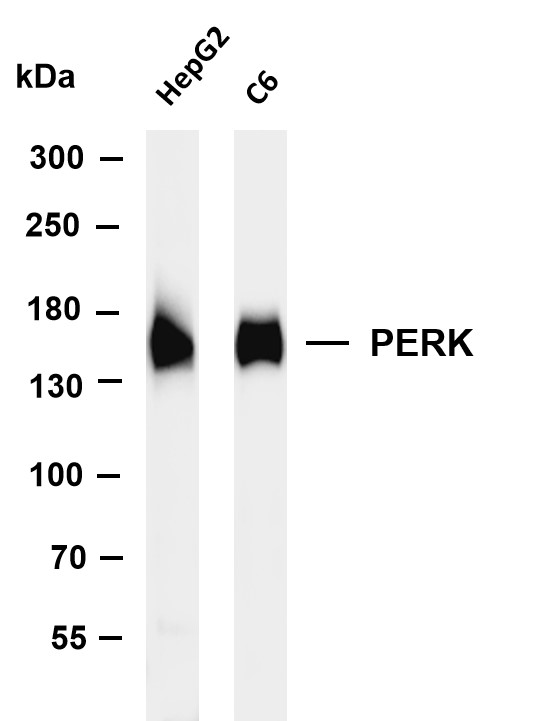 Recombinant PERK Monoclonal Antibody - 2