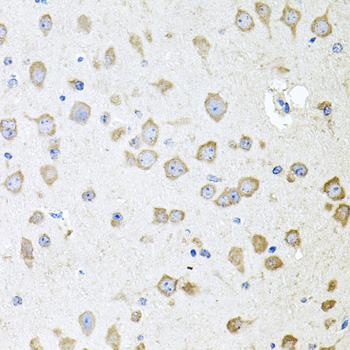Immunohistochemistry of paraffin-embedded Mouse brain using AKAP5 Polyclonal Antibody at dilution of 1:100 (40x lens).