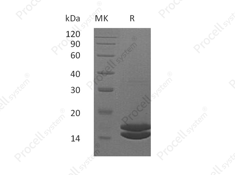 IL-2 (C-6His), Human, Recombinant