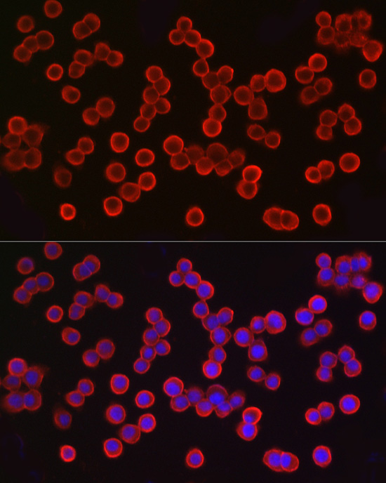 Immunofluorescence analysis of HT-29 cells using EpCAM Polyclonal antibody at dilution of 1:100 (40x lens). Blue: DAPI for nuclear staining.