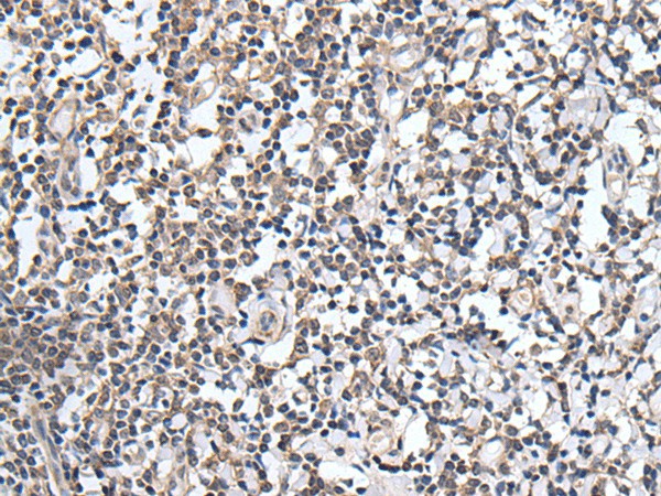 Immunohistochemistry of paraffin-embedded Human tonsil tissue  using PLAG1 Polyclonal Antibody at dilution of 1:25(?200)