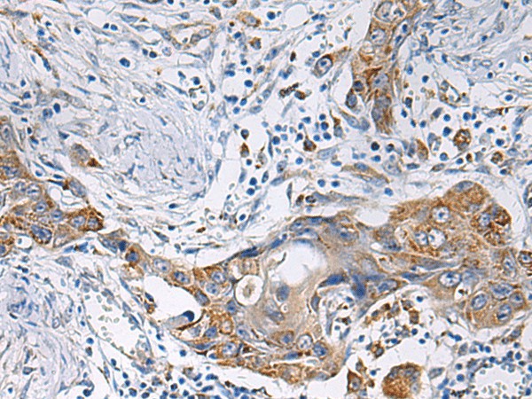 HSDL2 Polyclonal Antibody - small - 2