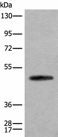 Western blot analysis of Human cerebella tissue lysate  using CADM2 Polyclonal Antibody at dilution of 1:2000