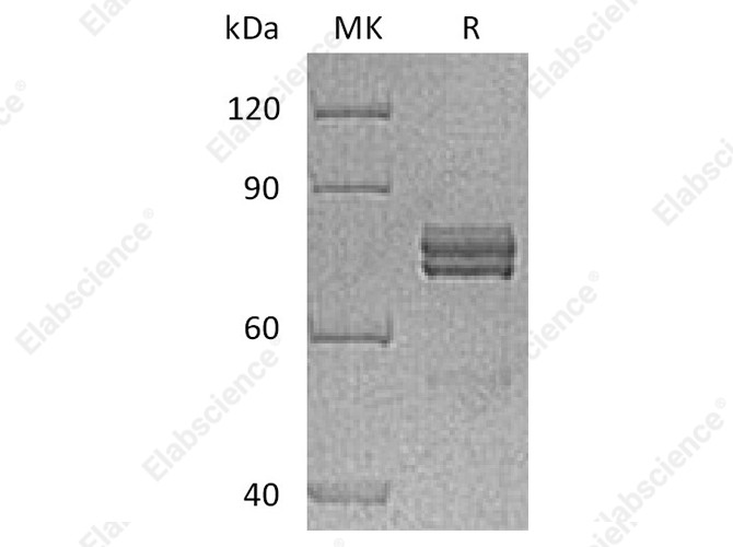 Recombinant Human CTGF/CCN2 Protein (Fc Tag) - 1