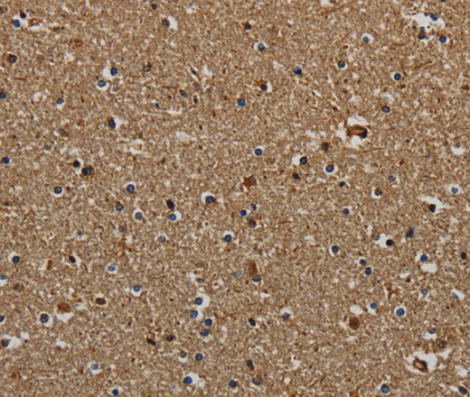 Immunohistochemistry of paraffin-embedded Human brain tissue using KLK6 Polyclonal Antibody at dilution 1:60