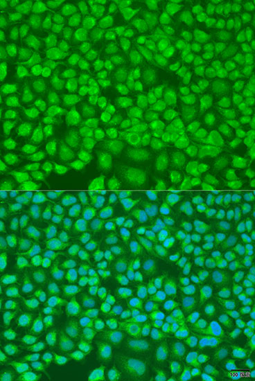 Immunofluorescence analysis of U2OS cells using PNKD Polyclonal Antibody at dilution of  1:100. Blue: DAPI for nuclear staining.