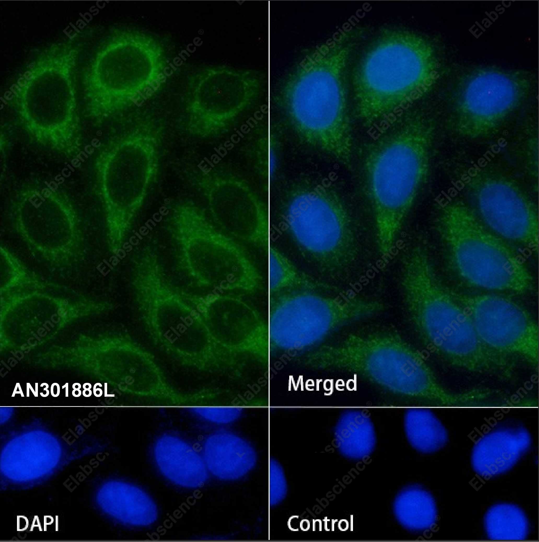 Recombinant SHIP-1 Monoclonal Antibody - 1