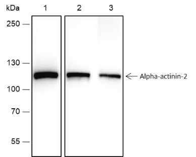 Recombinant alpha Actinin 2 Monoclonal Antibody - 2
