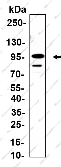 Recombinant PLOD2 Monoclonal Antibody - 3