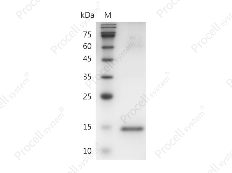 GM-CSF/CSF2/CSF, Human, Recombinant