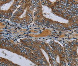 PCK2 Polyclonal Antibody - 3
