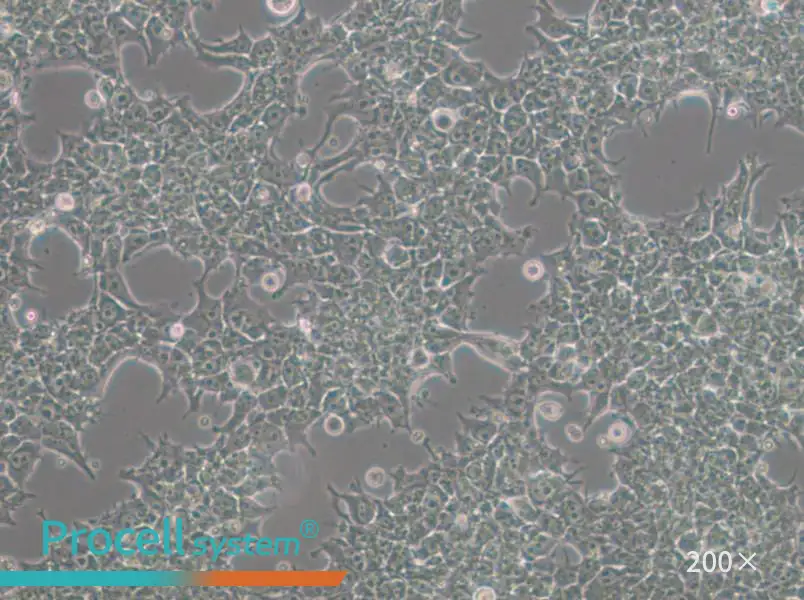 NCCIT Cell Complete Medium - 5