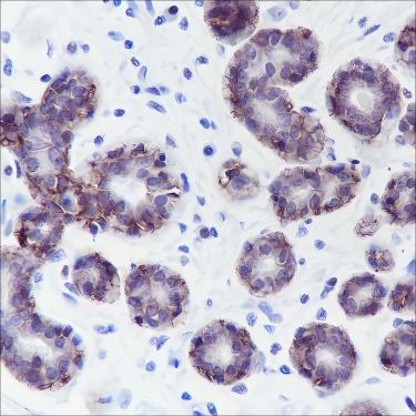 Recombinant TROP2 Monoclonal Antibody - 2