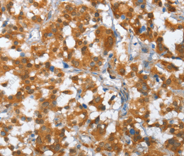 TP53BP2 Polyclonal Antibody - 2