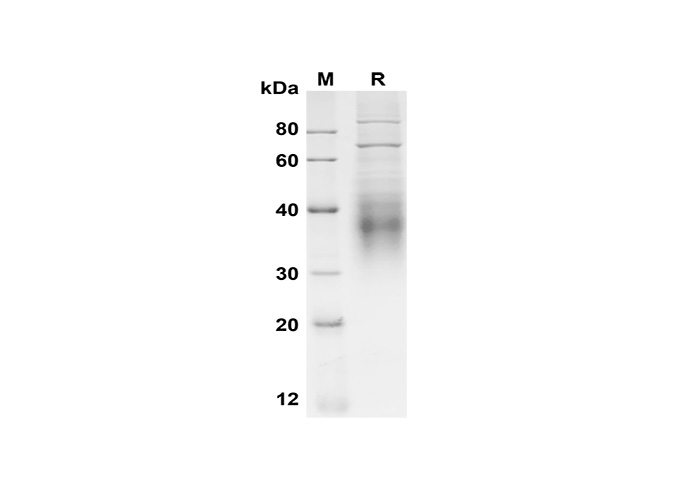 Recombinant Mouse Il17F Protein(Sumo Tag)-产品推荐-1