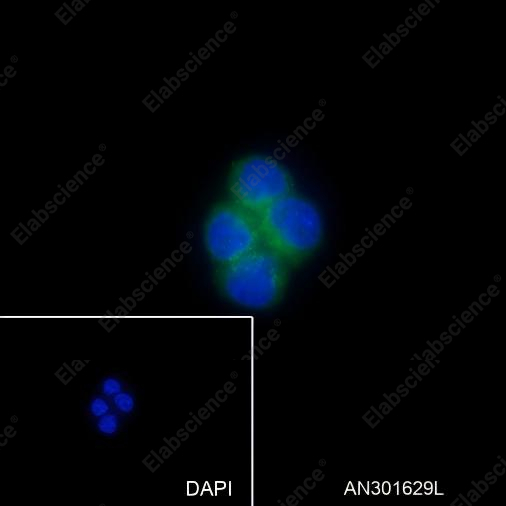 Recombinant PI3 Kinase p85 alpha Monoclonal Antibody - 3