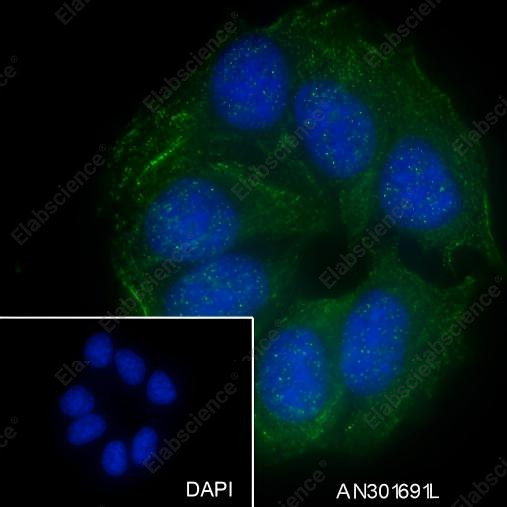 Recombinant GRP75 Monoclonal Antibody - 2