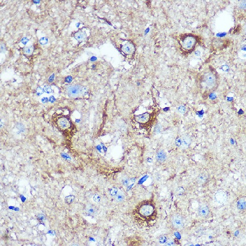 Immunohistochemistry of paraffin-embedded Mouse spinal cord using WWC1 Polyclonal Antibody at dilution of 1:100 (40x lens).Perform microwave antigen retrieval with 10 mM PBS buffer pH 7.2 before commencing with IHC staining protocol.