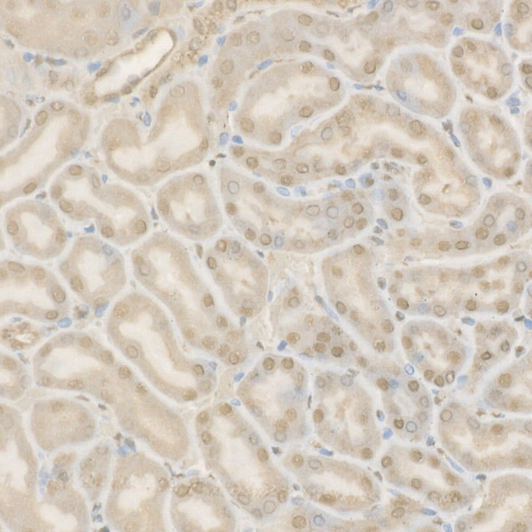 Immunohistochemistry of paraffin-embedded mouse kidney using Cleaved Caspase-9 P37 Polyclonal Antibody at dilution of 1:50 (40x lens).Perform high pressure antigen retrieval with 10 mM citrate buffer pH 6.0 before commencing with IHC staining protocol.