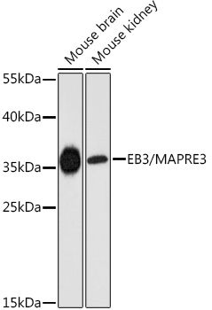 Western blot analysis of extracts of various cell lines using EB3/EB3/MAPRE3 Polyclonal Antibody at 1:3000 dilution.