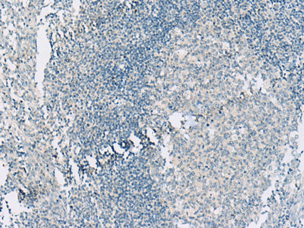 Immunohistochemistry of paraffin-embedded Human tonsil tissue  using HASPIN Polyclonal Antibody at dilution of 1:55(?200)