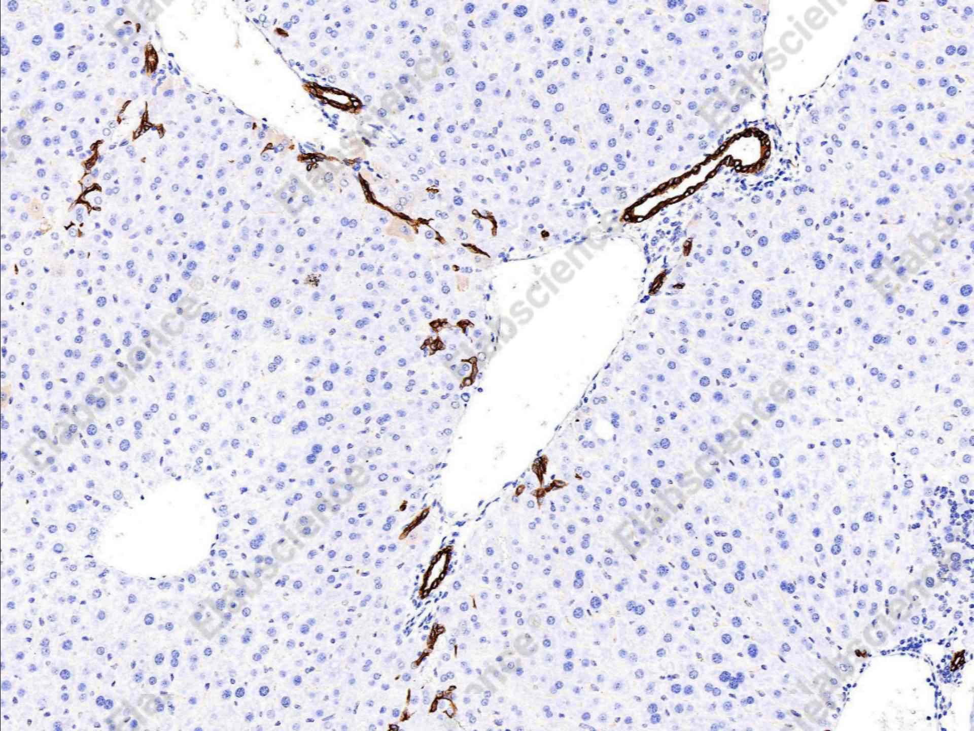 Recombinant Cytokeratin 7/KRT7 Monoclonal Antibody - 2