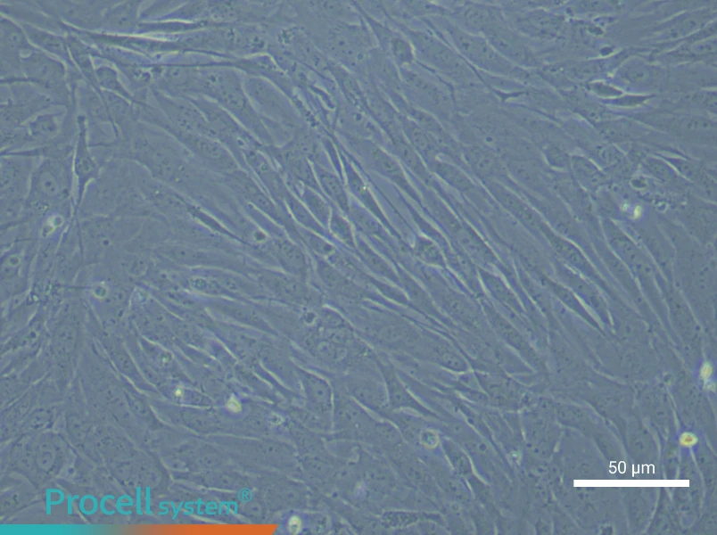 Human Aortic Smooth Muscle (Primary cell immortalization) Cell Complete Medium - 6
