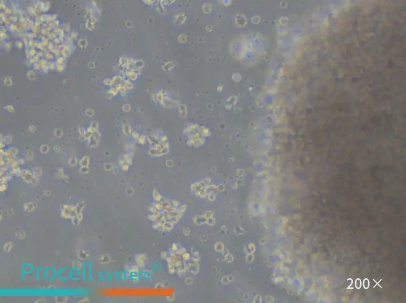 GM23687 Cell Complete Medium - 5