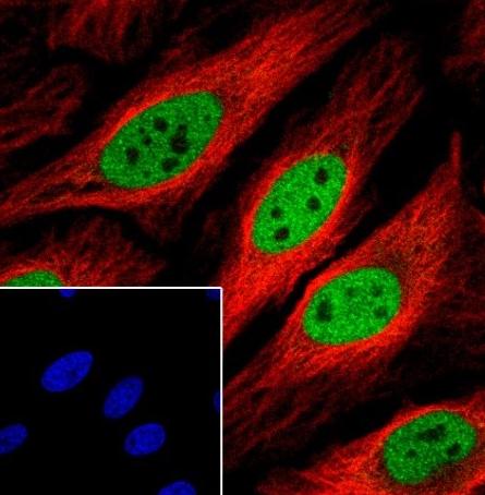 Recombinant MBD2 Monoclonal Antibody - small - 6