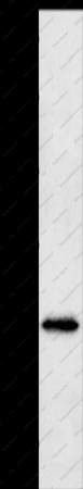 NEUROG1 Polyclonal Antibody - 1