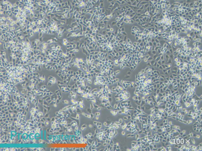 TOV-21G Cell Complete Medium - 3