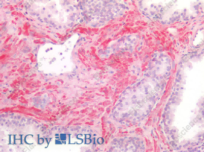 BMP4 Polyclonal Antibody - 2