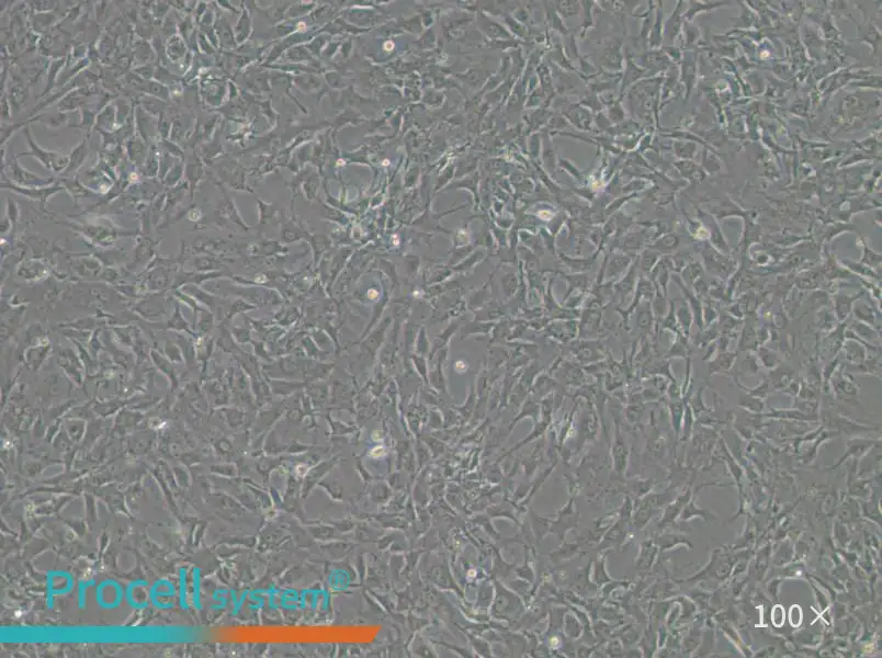 Tb 1 Lu Cell Complete MediumTb 1 Lu Cell Complete Medium - 3