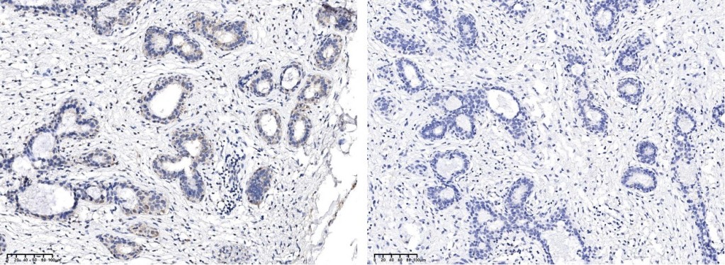 Recombinant Phospho-Stat5 (Tyr694) Monoclonal Antibody - small - 2