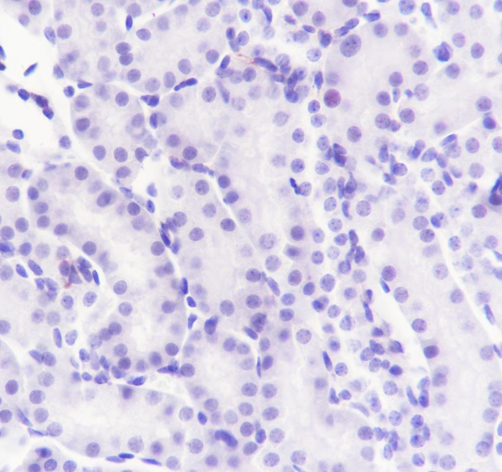 Recombinant Ryanodine Receptor Monoclonal Antibody - small - 3