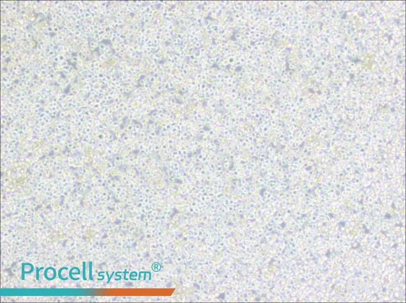 PC 61 5.3 [PC 61; PC 61.5.3] Cell Complete MediumPC 61 5.3 [PC 61; PC 61.5.3] Cell Complete Medium - 2