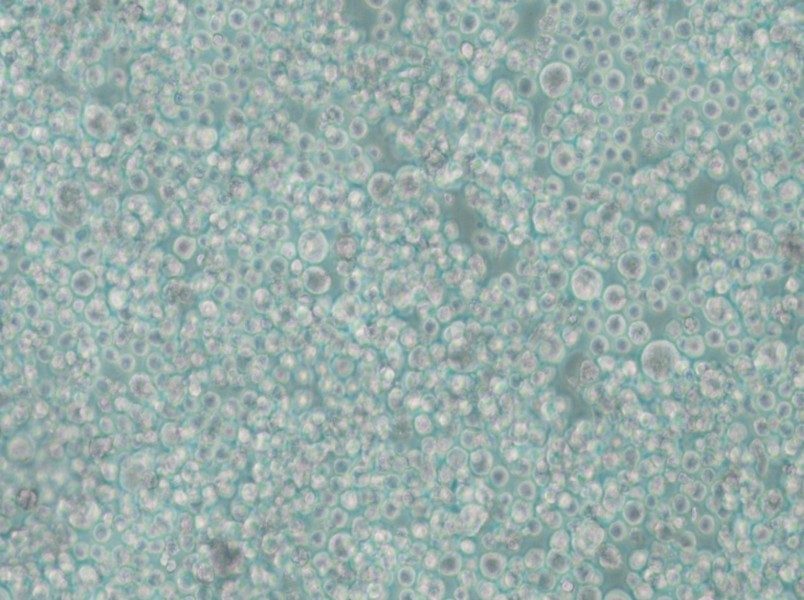 SU-DHL-2 Cell Complete Medium - small - 5