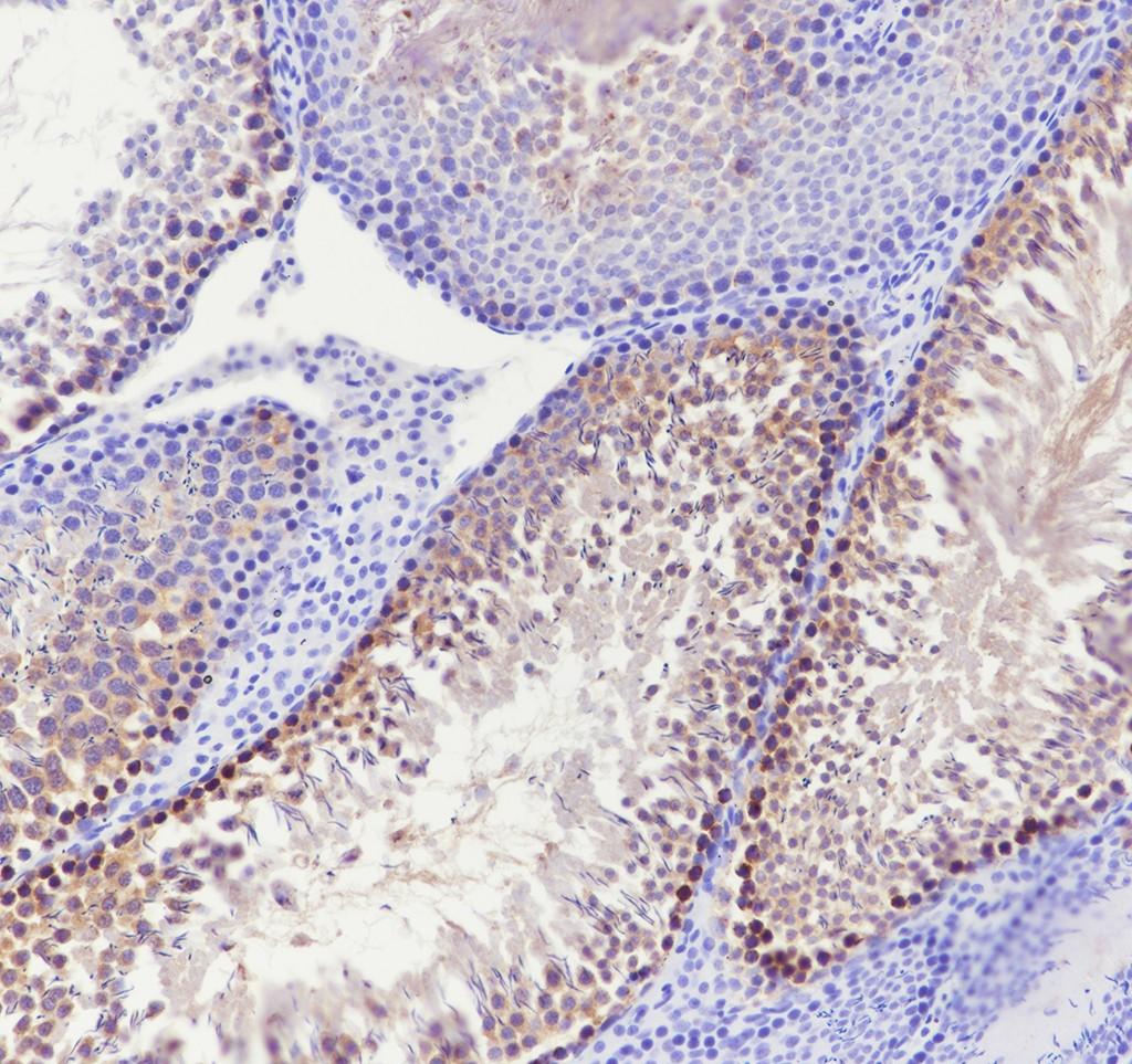 Recombinant CTCFL Monoclonal Antibody - small - 5