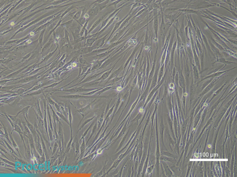 Human Tracheal Fibroblast Complete Medium - 2