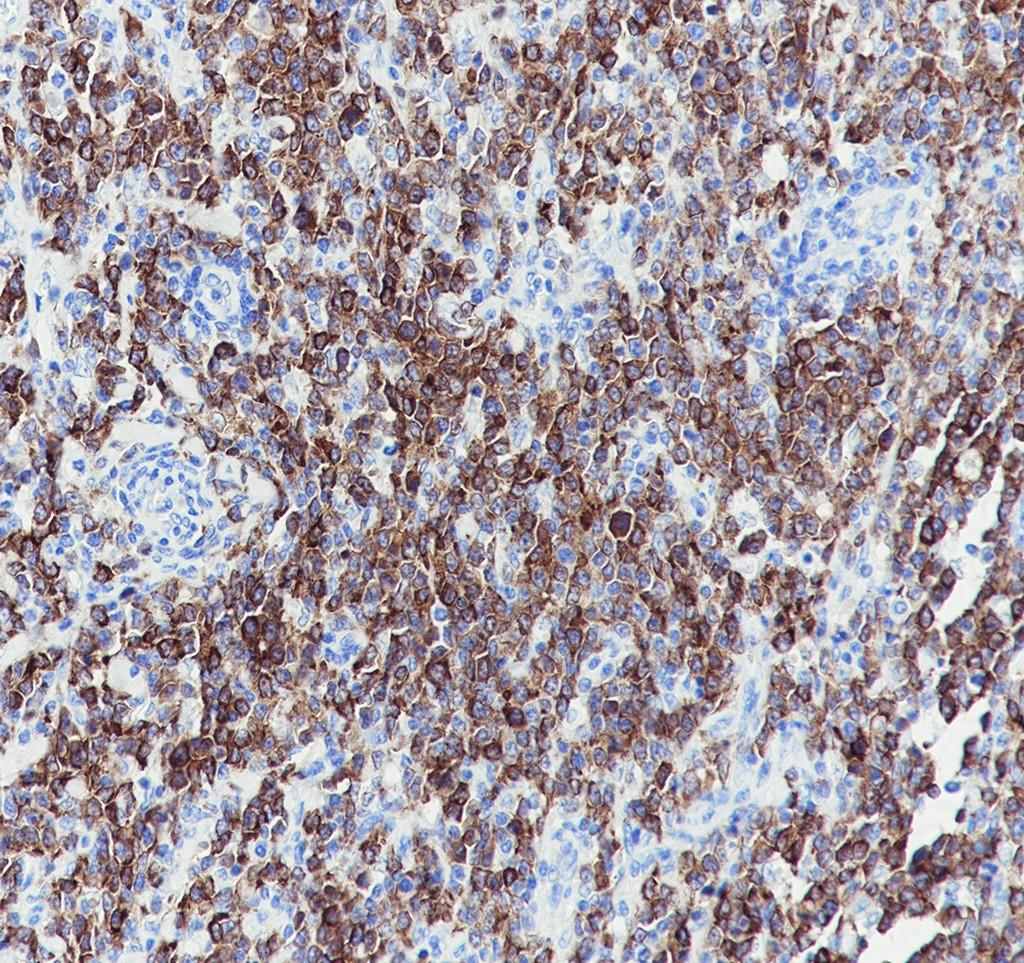 Recombinant AID Monoclonal Antibody - small - 3