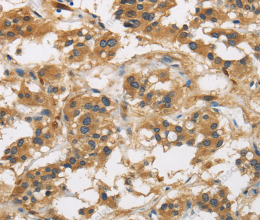 GAS7 Polyclonal Antibody - 2