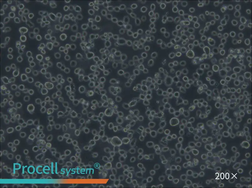 Karpas-299 Cell Complete Medium - 4