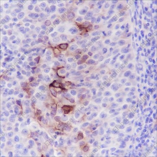 Recombinant MUC4 Monoclonal Antibody - 3