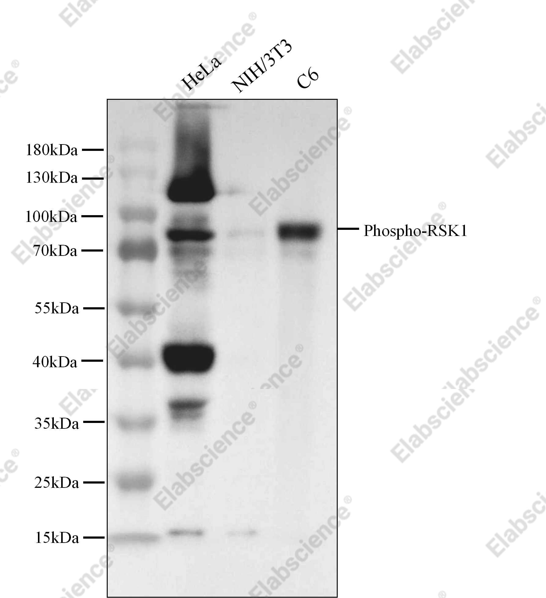 Recombinant Phospho-p90RSK (Thr359, Ser363) Monoclonal Antibody - 4