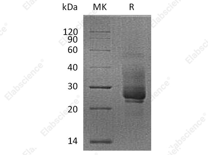 Recombinant Cynomolgus TIM-3/HAVCR2 Protein (His Tag) - 1